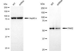 Western blotting analysis using PAK2 antibody (ABIN7799719).