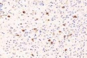 Immunohistochemistry analysis of paraffin-embedded mouse brain using RASGRP3 (ABIN7075376) at dilution of 1: 1000 (RASGRP3 antibody)