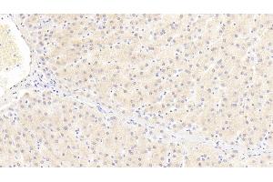 Detection of ITIH4 in Human Liver Tissue using Polyclonal Antibody to Inter Alpha-Globulin Inhibitor H4 (ITIH4) (ITIH4 antibody  (AA 29-157))