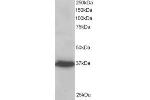 Western Blotting (WB) image for anti-PDZ and LIM Domain 4 (PDLIM4) (C-Term) antibody (ABIN2466091) (PDLIM4 antibody  (C-Term))