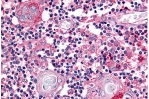 Human Thymus (formalin-fixed, paraffin-embedded) stained with USP4 antibody ABIN213585 at 5 ug/ml followed by biotinylated goat anti-rabbit IgG secondary antibody ABIN481713, alkaline phosphatase-streptavidin and chromogen. (USP4 antibody  (Internal Region))