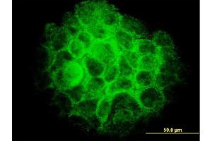 Immunofluorescence of monoclonal antibody to TRIB3 on A-431 cell. (TRIB3 antibody  (AA 56-145))