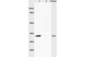 Lane 1: mouse brain lysates Lane 2: mouse kidney lysates probed with Anti SDHB Polyclonal Antibody, Unconjugated (ABIN719411) at 1:200 in 4 °C. (SDHB antibody  (AA 201-280))