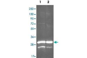 Western Blot analysis by gdh polyclonal antibody  at 1:3000. (Glutamate Dehydrogenase (GDH) antibody)