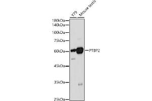 Western blot analysis of extracts of various cell lines, using PTBP2 antibody (ABIN6128372, ABIN6146373, ABIN6146374 and ABIN6221684) at 1:1000 dilution.