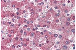 Human Liver: Formalin-Fixed, Paraffin-Embedded (FFPE) (RBP4 antibody  (AA 19-202))