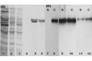 SDS–PAGE and Western blots that confirm LLO production by three of the constructed strains. (LLO antibody)
