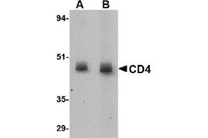 Western Blotting (WB) image for anti-CD4 (CD4) (N-Term) antibody (ABIN492544) (CD4 antibody  (N-Term))
