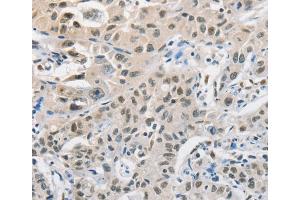 Immunohistochemistry (IHC) image for anti-Cell Division Cycle 27 Homolog (S. Cerevisiae) (CDC27) antibody (ABIN2427930) (CDC27 antibody)