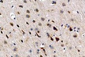 Immunohistochemistry analysis of paraffin-embedded rat brain using,SLC6A15 (ABIN7075681) at dilution of 1: 600