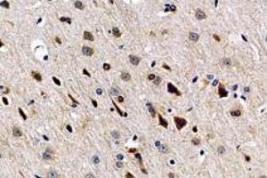 Immunohistochemistry analysis of paraffin-embedded rat brain using,SLC6A15 (ABIN7075681) at dilution of 1: 600 (SLC6A15 antibody)