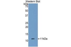 Detection of Recombinant HSPA8, Human using Polyclonal Antibody to Heat Shock 70 kDa Protein 8 (HSPA8) (Hsc70 antibody  (AA 534-615))