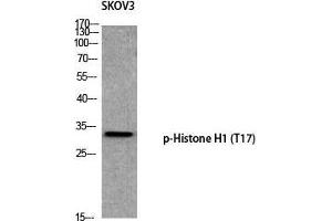 Western Blot (WB) analysis of SKOV3 using p-Histone H1 (T17) antibody.