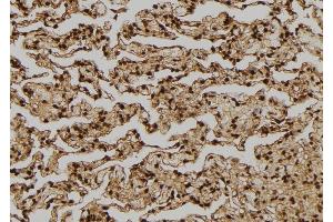 ABIN6276314 at 1/100 staining Human lung tissue by IHC-P. (FGF2 antibody  (C-Term))