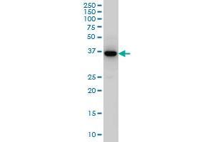 SEPT3 monoclonal antibody (M03), clone 4D8 Western Blot analysis of SEPT3 expression in Jurkat . (Septin 3 antibody  (AA 236-345))