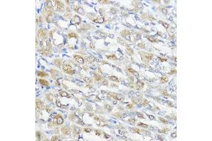 Immunohistochemistry of paraffin-embedded rat stomach using GPX2 antibody (ABIN7267435) at dilution of 1:100 (40x lens). (Glutathione Peroxidase 2 antibody  (AA 100-180))