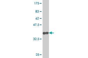 Western Blot detection against Immunogen (36. (Nucleostemin antibody  (AA 328-427))