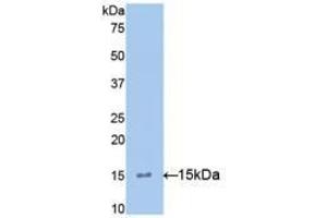 Western blot analysis of recombinant Mouse IL15. (IL-15 antibody  (AA 49-162))
