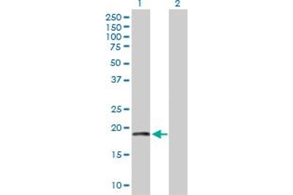 TIMM22 antibody  (AA 1-194)