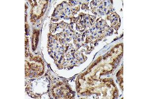 Immunohistochemistry of paraffin-embedded human kidney using Human IgM Rabbit mAb (ABIN7267845) at dilution of 1:100 (40x lens). (IGHM antibody)