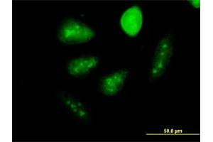 Immunofluorescence of monoclonal antibody to GCM1 on HeLa cell. (GCM1 antibody  (AA 108-166))