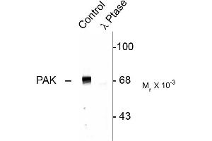 Western blots of rat hippocampal lysate showing specific immunolabeling of the ~68k to ~70k PAK protein (Control). (PAK1-3 (pThr402) antibody)