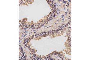 (ABIN6243855 and ABIN6577442) staining RK7 in human prostate tissue sections by Immunohistochemistry (IHC-P - raformaldehyde-fixed, raffin-embedded sections). (PARK7/DJ1 antibody  (C-Term))