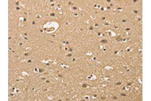 The image on the left is immunohistochemistry of paraffin-embedded Human brain tissue using ABIN7128351(ALDH8A1 Antibody) at dilution 1/30, on the right is treated with fusion protein. (ALDH8A1 antibody)