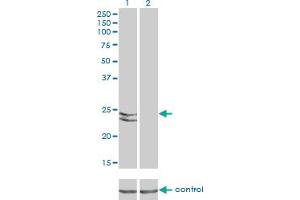 Western Blotting (WB) image for anti-RAB27A, Member RAS Oncogene Family (RAB27A) (AA 122-222) antibody (ABIN598569) (RAB27A antibody  (AA 122-222))