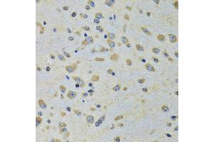 Immunohistochemistry of paraffin-embedded rat brain using DARS antibody (ABIN5973949) at dilution of 1/100 (40x lens). (DARS antibody)