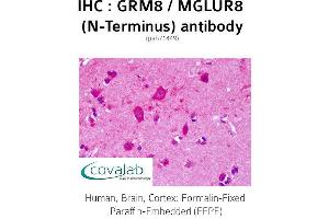 Image no. 1 for anti-Glutamate Receptor, Metabotropic 8 (GRM8) (Extracellular Domain), (N-Term) antibody (ABIN1735284) (GRM8 antibody  (Extracellular Domain, N-Term))