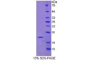 SDS-PAGE analysis of Human NARF Protein. (NARF Protein)