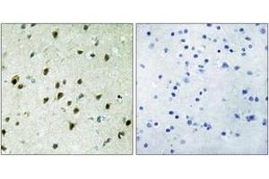 Immunohistochemistry analysis of paraffin-embedded human brain tissue, using MAD4 Antibody. (MXD4 antibody  (AA 10-59))