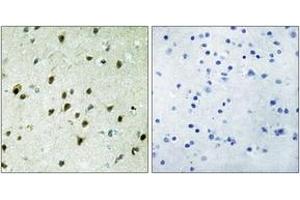 Immunohistochemistry analysis of paraffin-embedded human brain tissue, using MAD4 Antibody. (MXD4 antibody  (AA 10-59))