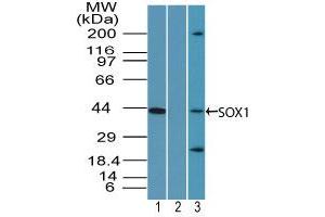 Image no. 1 for anti-SRY (Sex Determining Region Y)-Box 1 (SOX1) (AA 350-400) antibody (ABIN960349) (SOX1 antibody  (AA 350-400))