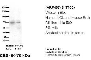 Image no. 2 for anti-Cystathionine-beta-Synthase (CBS) (N-Term) antibody (ABIN2782348) (CBS antibody  (N-Term))