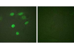 P-peptide - +Immunofluorescence analysis of HeLa cells, using CDC16/APC6 (Phospho-Ser560) antibody. (CDC16 antibody  (pSer560))