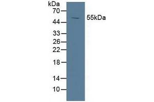 Detection of LXRa in Porcine Spleen Tissue using Polyclonal Antibody to Liver X Receptor Alpha (LXRa) (NR1H3 antibody  (AA 95-434))