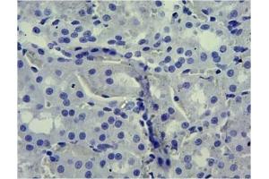 ABIN870680 Negative Control showing staining of paraffin embedded Rat Kidney, with no primary antibody. (SLC5A1 antibody  (Internal Region))