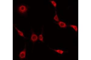 ABIN6275026 staining HuvEc by IF/ICC. (BEND4 antibody  (Internal Region))
