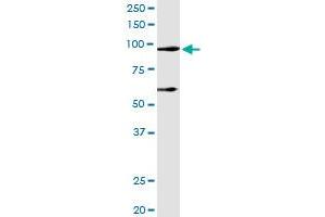 Immunoprecipitation of DDX54 transfected lysate using anti-DDX54 MaxPab rabbit polyclonal antibody and Protein A Magnetic Bead , and immunoblotted with DDX54 MaxPab mouse polyclonal antibody (B01) . (DDX54 antibody  (AA 1-881))