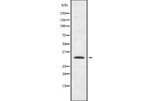 Western blot analysis SHOX using MCF7 whole cell lysates (SHOX antibody  (N-Term))