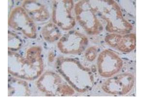 Figure. (JAG2 antibody  (AA 714-981))