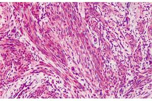Human Muscle: Formalin-Fixed, Paraffin-Embedded (FFPE) (Vinculin antibody)