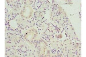 Immunohistochemistry of paraffin-embedded human pancreatic tissue using ABIN7145599 at dilution of 1:100 (Biliverdin Reductase antibody  (AA 1-296))