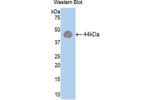WB of Protein Standard: different control antibodies against Highly purified E. (Hexokinase 1 ELISA Kit)
