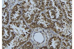 ABIN6268681 at 1/100 staining Mouse testis tissue by IHC-P. (SIRT3 antibody  (C-Term))