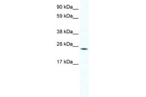 Western Blotting (WB) image for anti-Homeobox B7 (HOXB7) antibody (ABIN2461469)