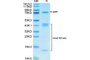 Human GARP(Y137H)&Latent TGF Beta Complex on Tris-Bis PAGE under reduced condition.