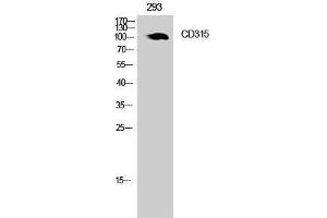 Western Blotting (WB) image for anti-Prostaglandin F2 Receptor Negative Regulator (PTGFRN) (Internal Region) antibody (ABIN3181475) (PTGFRN antibody  (Internal Region))